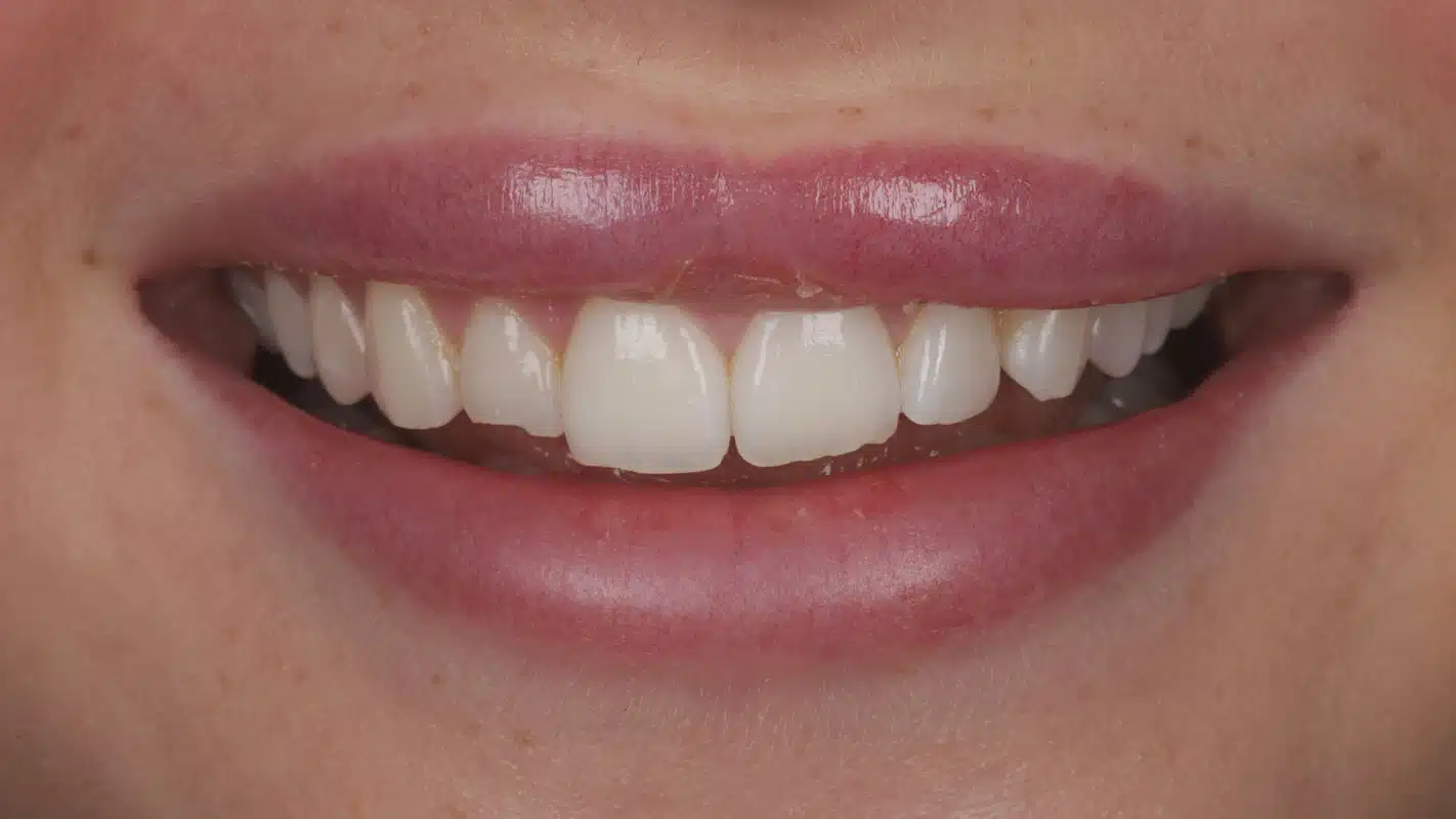 Sophie before treatment